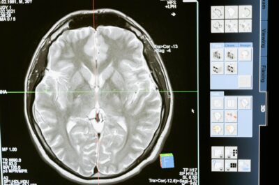 Psychological Testing Explained: Understanding the Process, the Tests, and When it Can Help